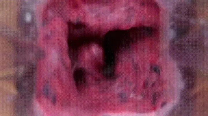 O gif